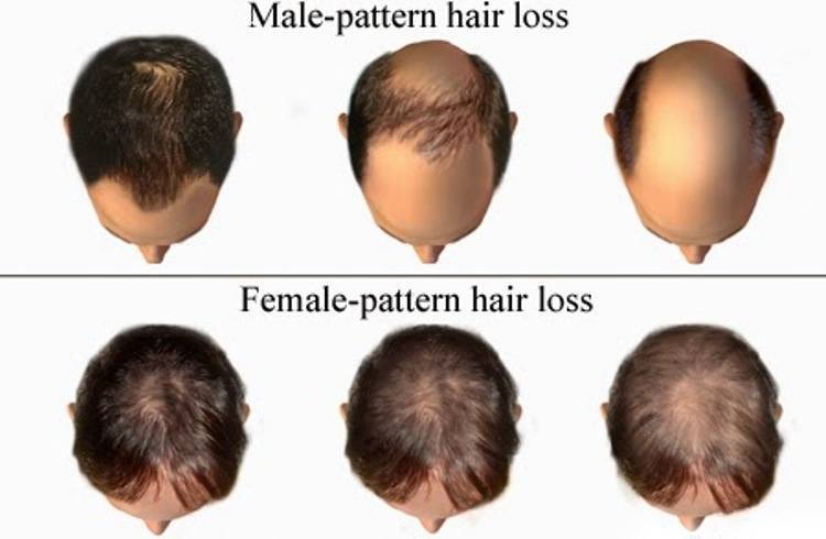 Source: fuehairtransplant.blog.com