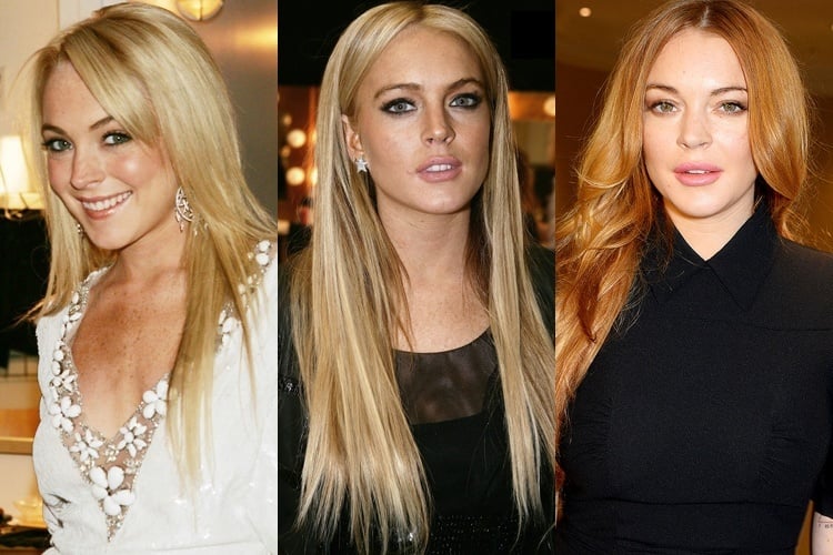 lindsay-lohan-before-and-after-surgery.jpg