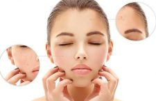 Open Pores Treatment