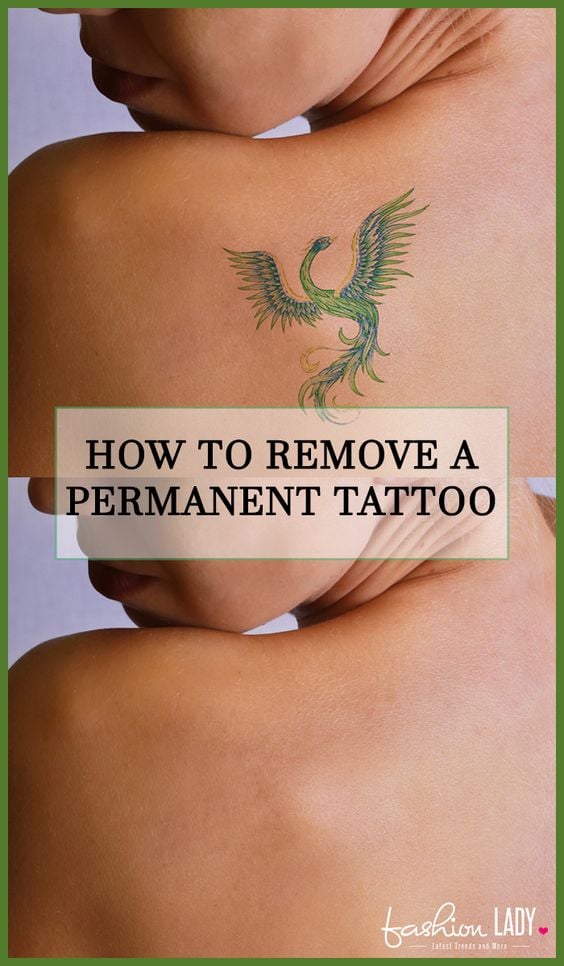 How To Remove A Permanent Tattoo: DIY Methods and Surgical ...