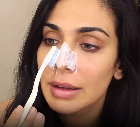 can toothpaste get rid of lip pimples