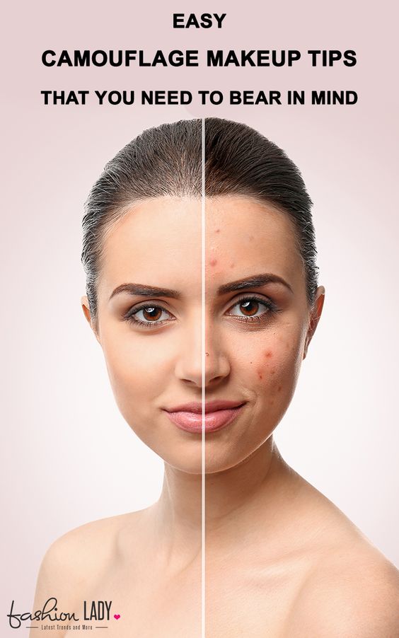 Easy Camouflage Makeup Tips That You Need To Bear In Mind!