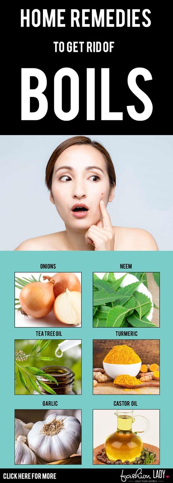 32 Amazing Home Remedies To Get Rid Of Boils