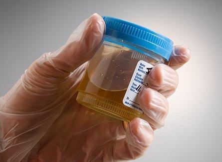 Urine-for-acne-myth Urine for acne myth