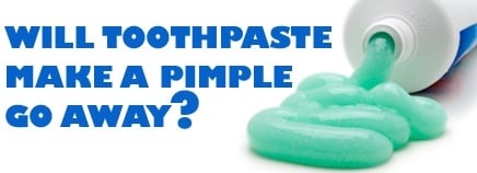 toothpaste for pimples