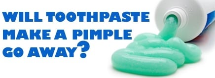 toothpaste-for-pimples toothpaste for pimples