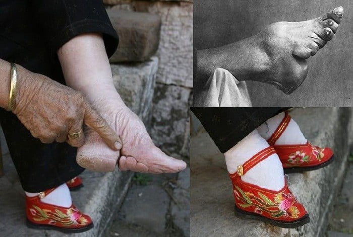 FootBinding ridiculous fashion trend