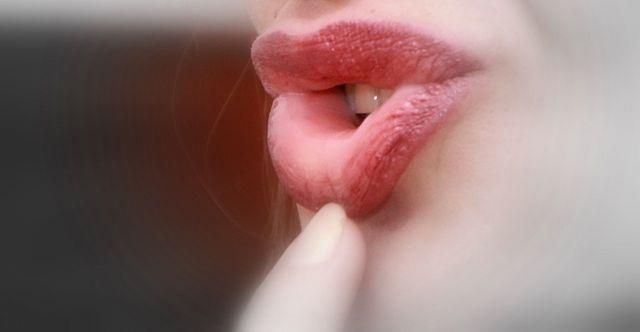 chapped-lips-remedy