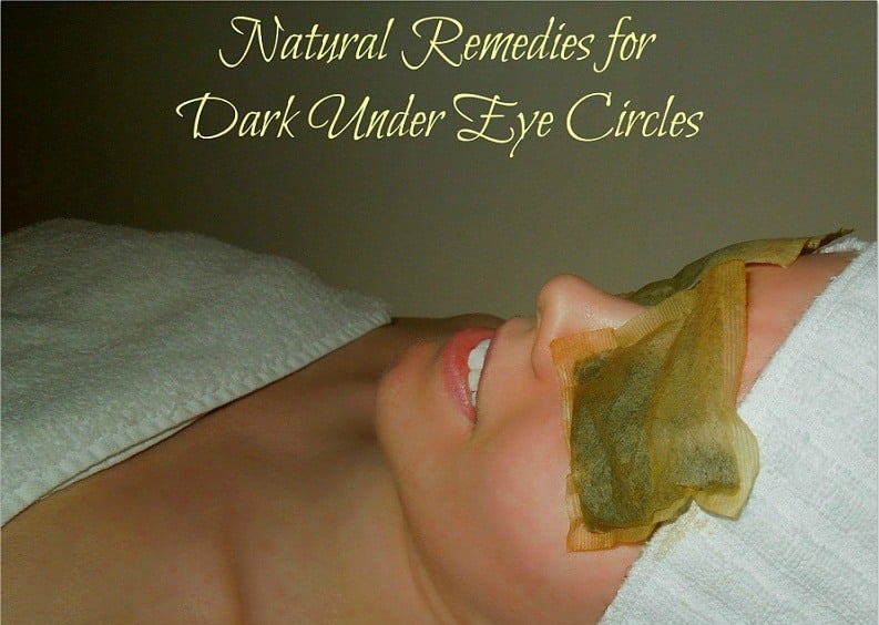 Natural Remedies for Dark Under Eye Circles