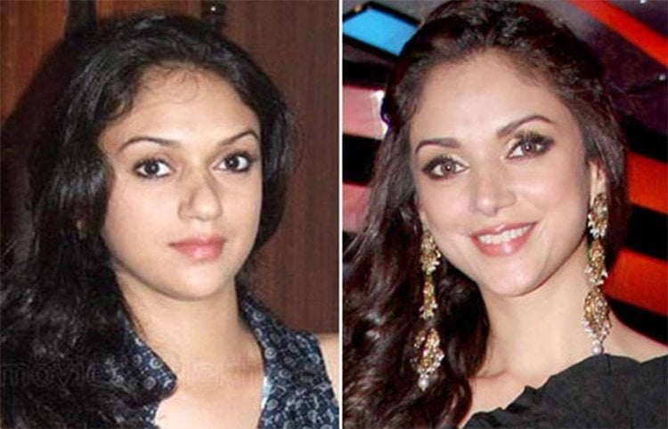 Aditi Rao Hydari Plastic surgery