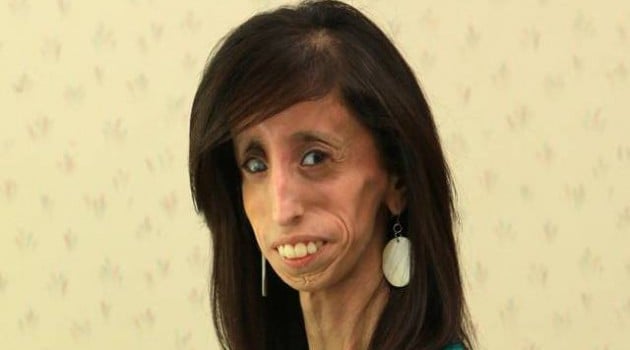 Lizzie Velasquez