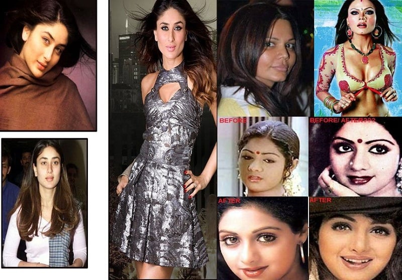 Bollywood Plastic Surgeries