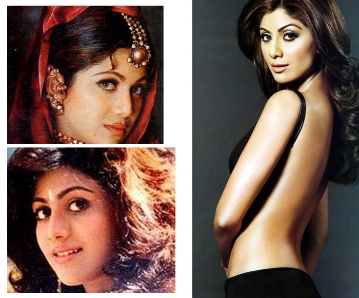 Shilpa Shetty Plastic Surgery