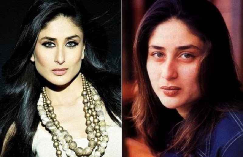 Kareena Kapoor Plastic Surgery