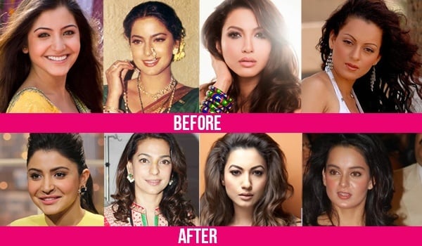 Bollywood Plastic Surgeries