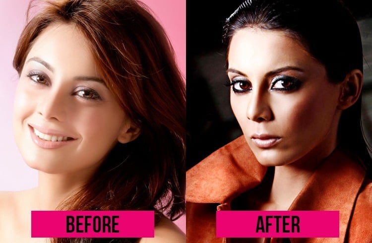 Minishaa Lamba Plastic Surgery 