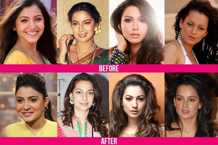 Bollywood Plastic Surgeries