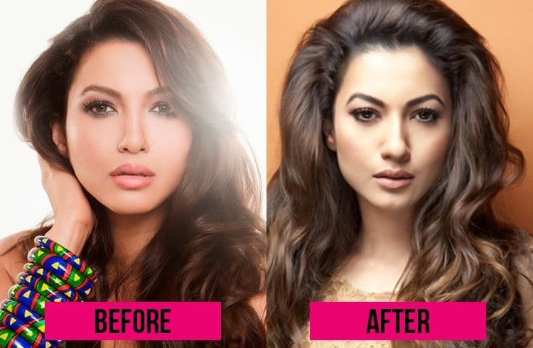 Gauhar Khan Before and After Surgery 