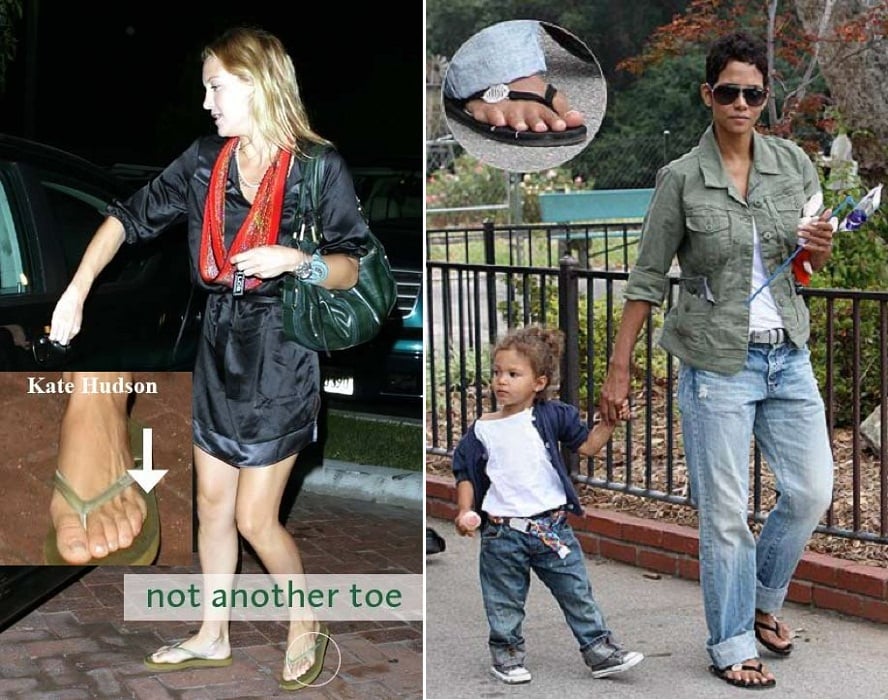kate halle berry 6th toe