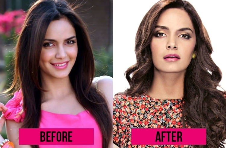 Shazahn Padamsee Surgery 