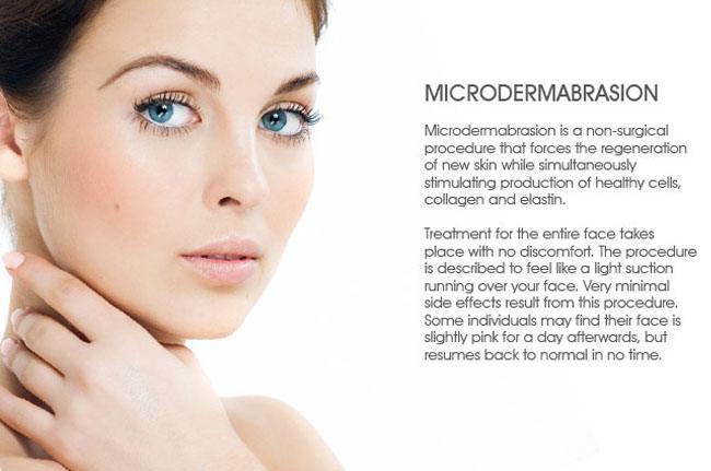 How Microdermabrasion works