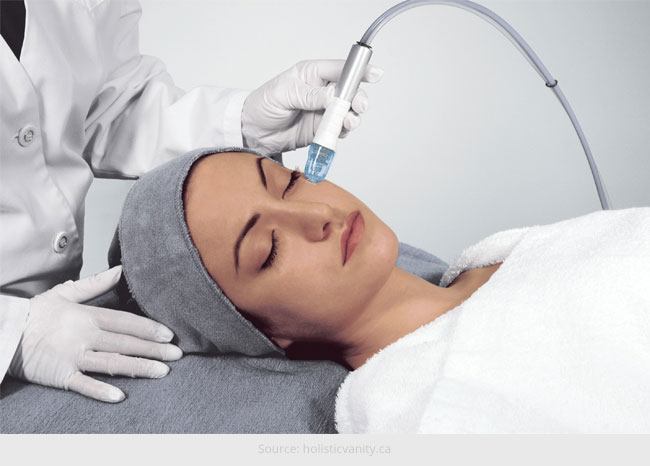 How Microdermabrasion Works