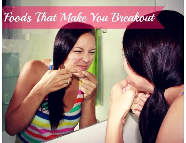 Acne Breakouts
