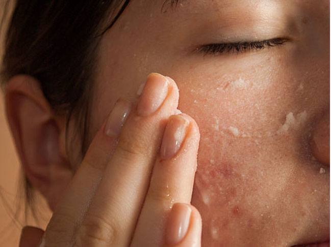 Retinol Can Be Further Broken Into Retinol, Retinoids, and Tretinoin