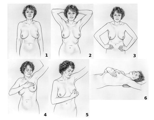 Breast Cancer Self Examination 