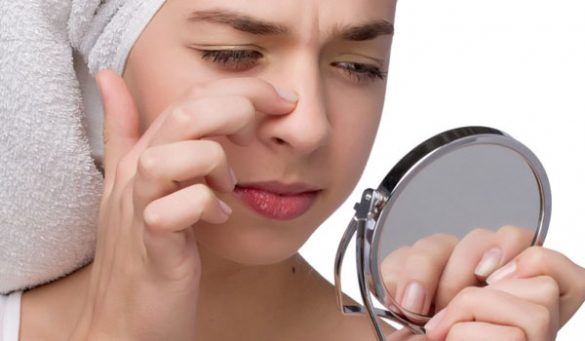 Home Remedies for Blackheads