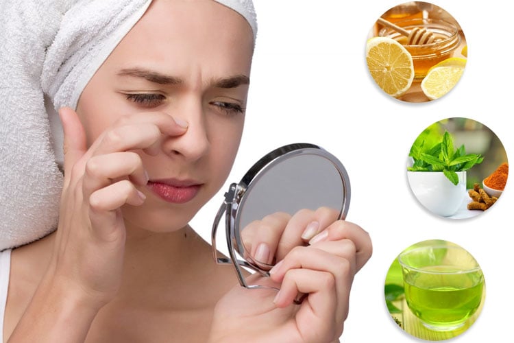 Home Remedies To Get Rid Of Blackheads