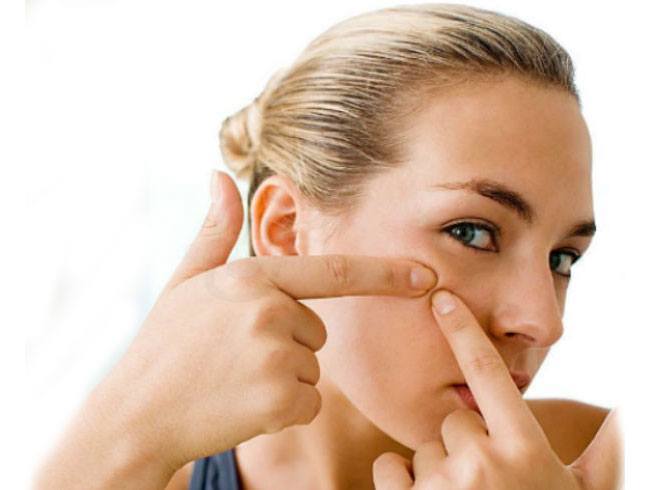 You are Facing Acne Flare Ups