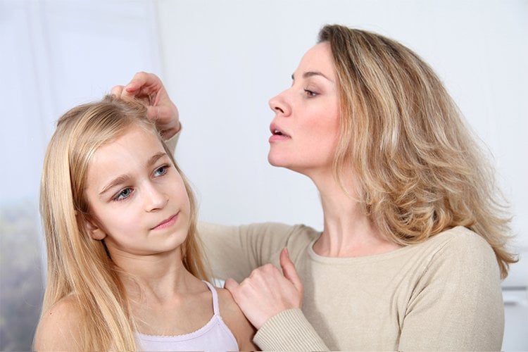 Home Remedies for Hair Lice