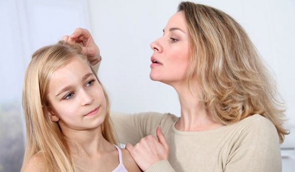 Home Remedies for Hair Lice