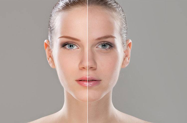 Home Remedies for Glowing Skin