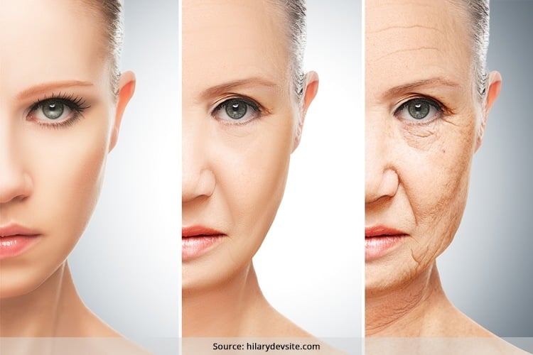 Signs of Aging
