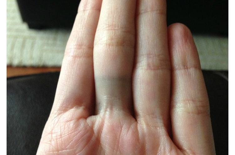 What Metal Turns Your Skin Green 2024 favors