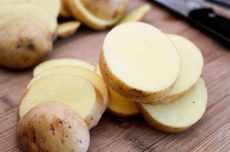 Buttermilk and Potato Tips for Freckles