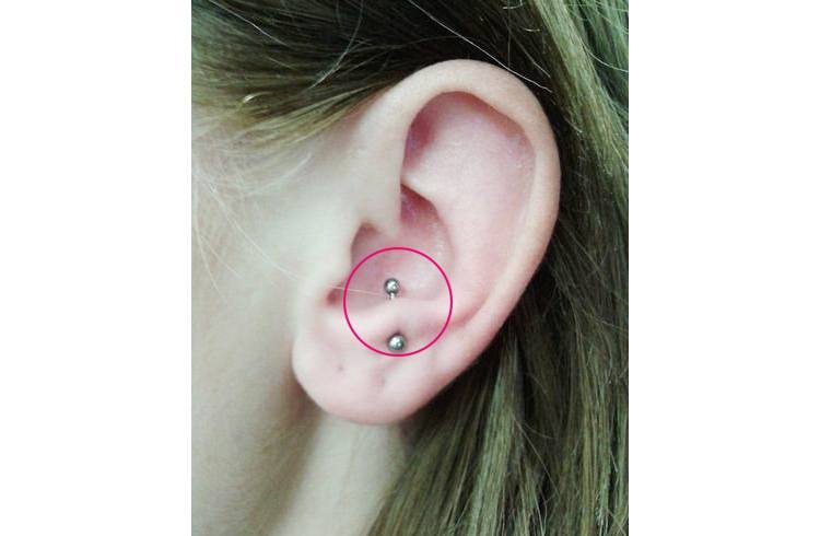 Anti Tragus Ear Piercing