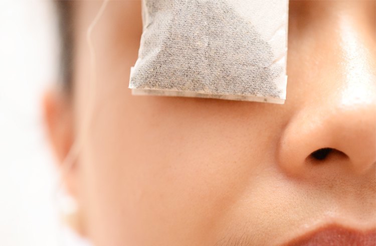 Tea Bags for the Eye Treatment