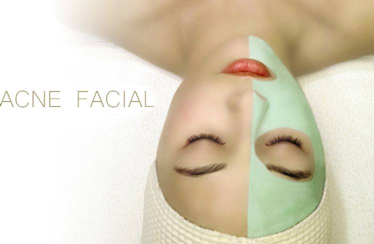 Acne facial