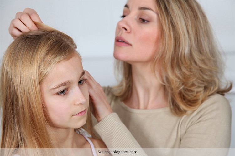 Treat Lice In Hair At Home