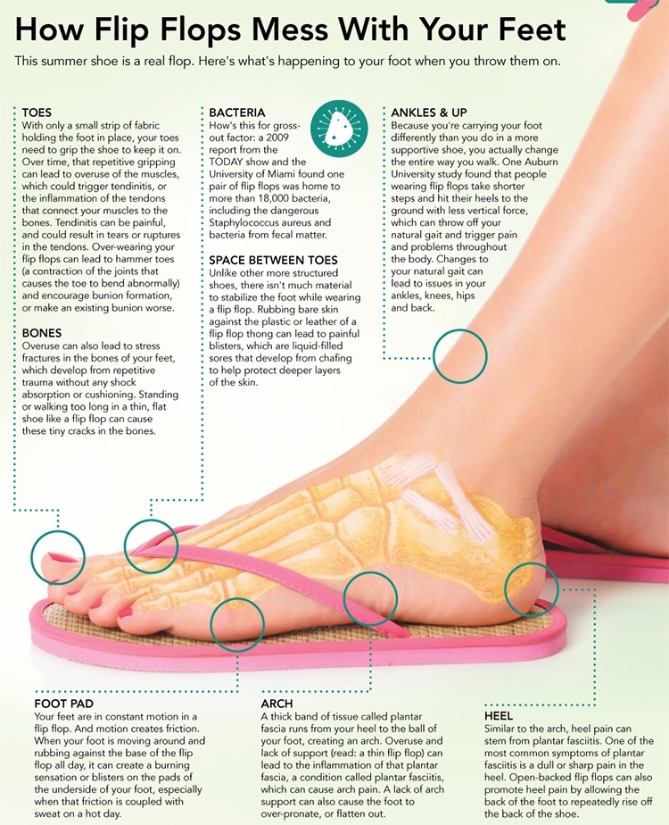 Tips to avoid wearing flip-flops