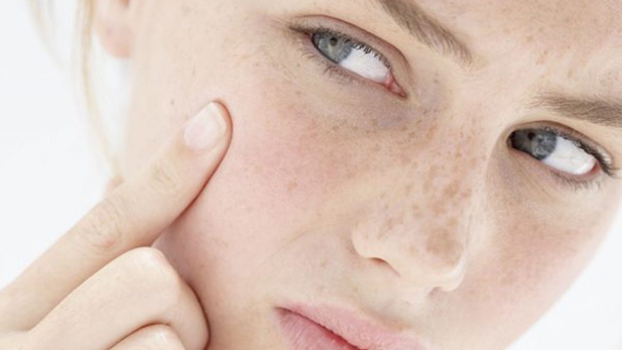 dry spot prone skin