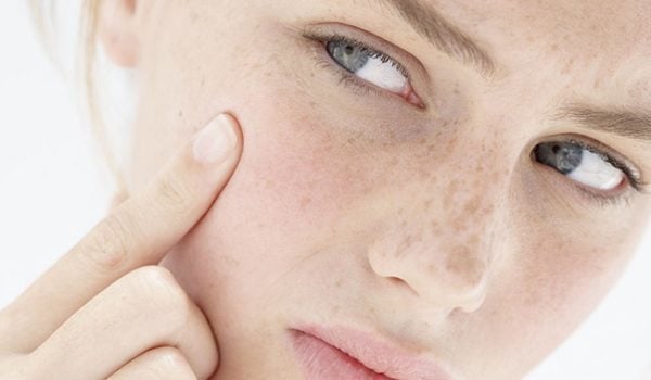 best treatment for dry acne prone skin