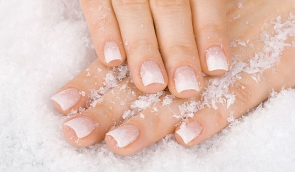 Dry Skin Around Nails: You Need More Than Just Manicure! Dry Skin Around Nails: You Need More Than Just Manicure!