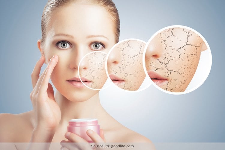 Dry Skin Patches