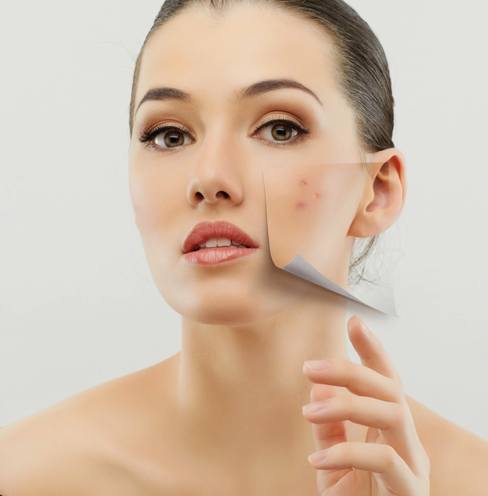 treatments for dry skin acne
