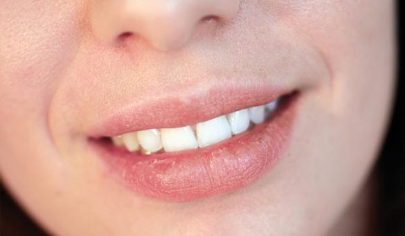 Cause of Dry Lips