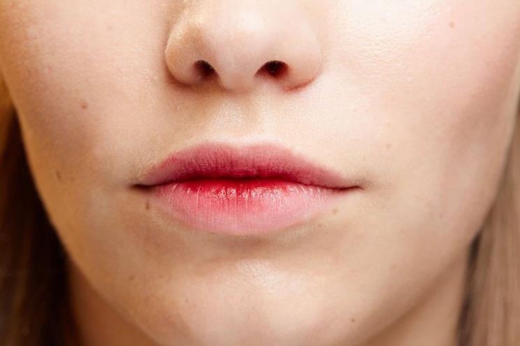 Dry Lip Causes